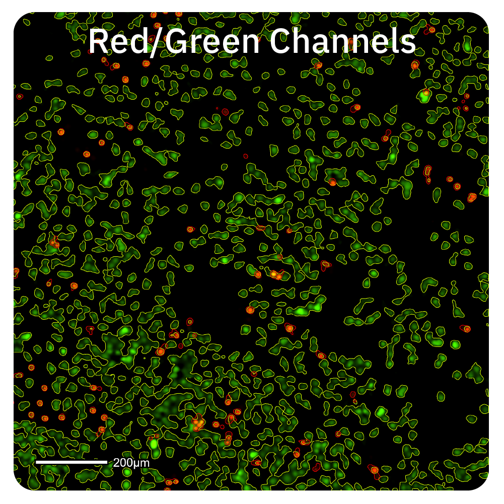 Red/Green Channels