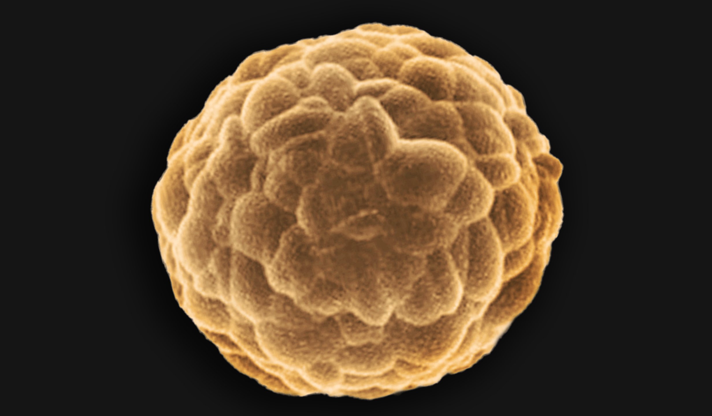 Cancer Spheroid