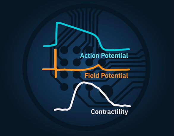 Cardiac Characterization