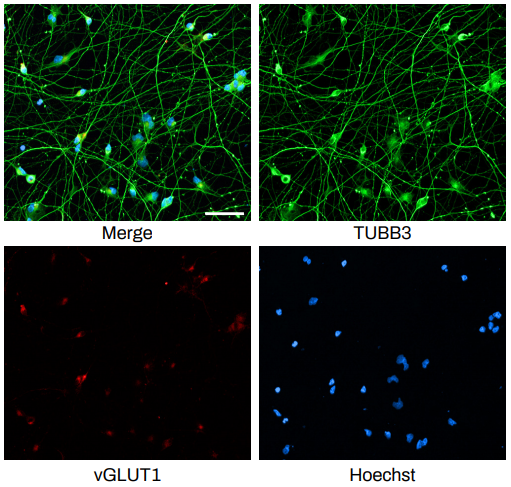 Immunofluorescent staining of neurite growth