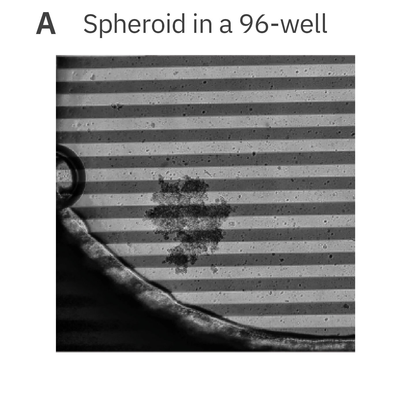 Cancer Spheroid imaged in a CytoView-Z impedance well bottom