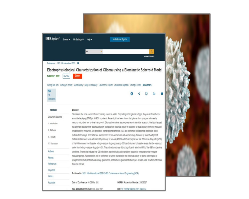 Electrophysiological Characterization Glioma