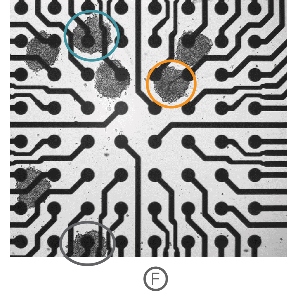 Ncardia speroids were deposited in a CytoView MEA 6-well plate