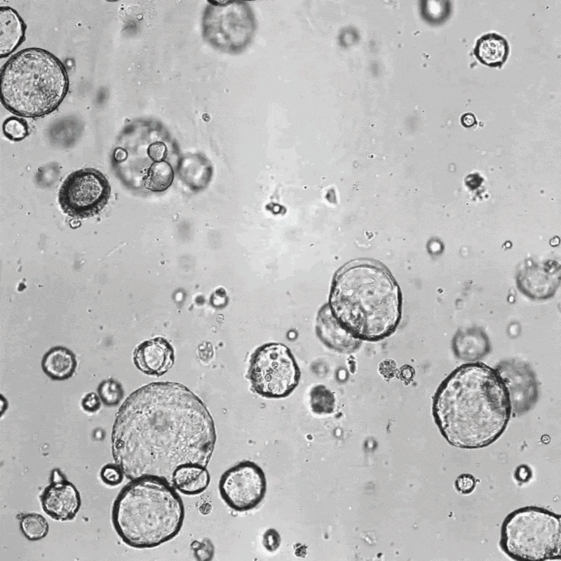 Whole-vessel brightfield image showing multiple organoids