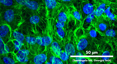 rat cortical neurons on multiwell OptiClear plate