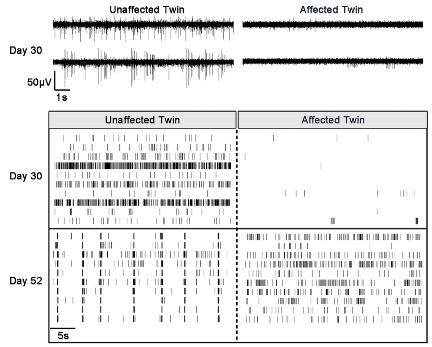 Results from studies of Parkinsons Disease