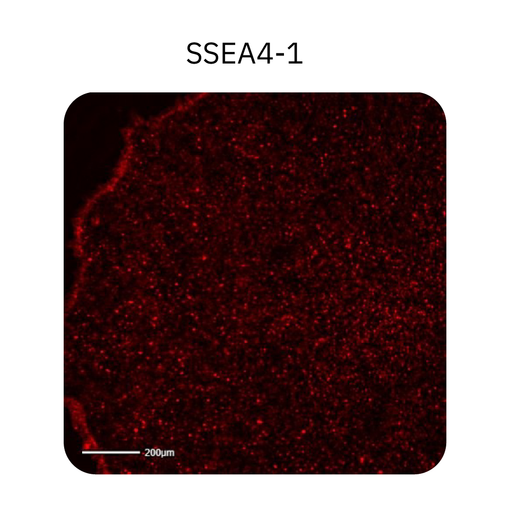 Human iPSC colonies were stained with a pluripotent marker, TRA-1-60, and imaged in the green fluorescence channel on the Omni platform 