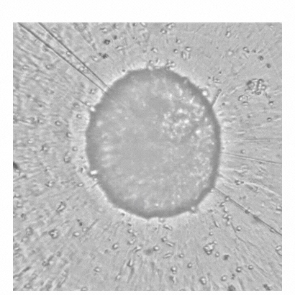Cancer spheroid imaging on the Omni of CAR cell killing