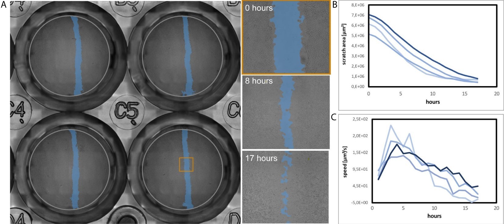 The analysis of C6 glioma cell migration.