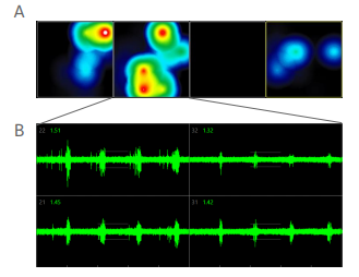 Cortical organoid neural network activity