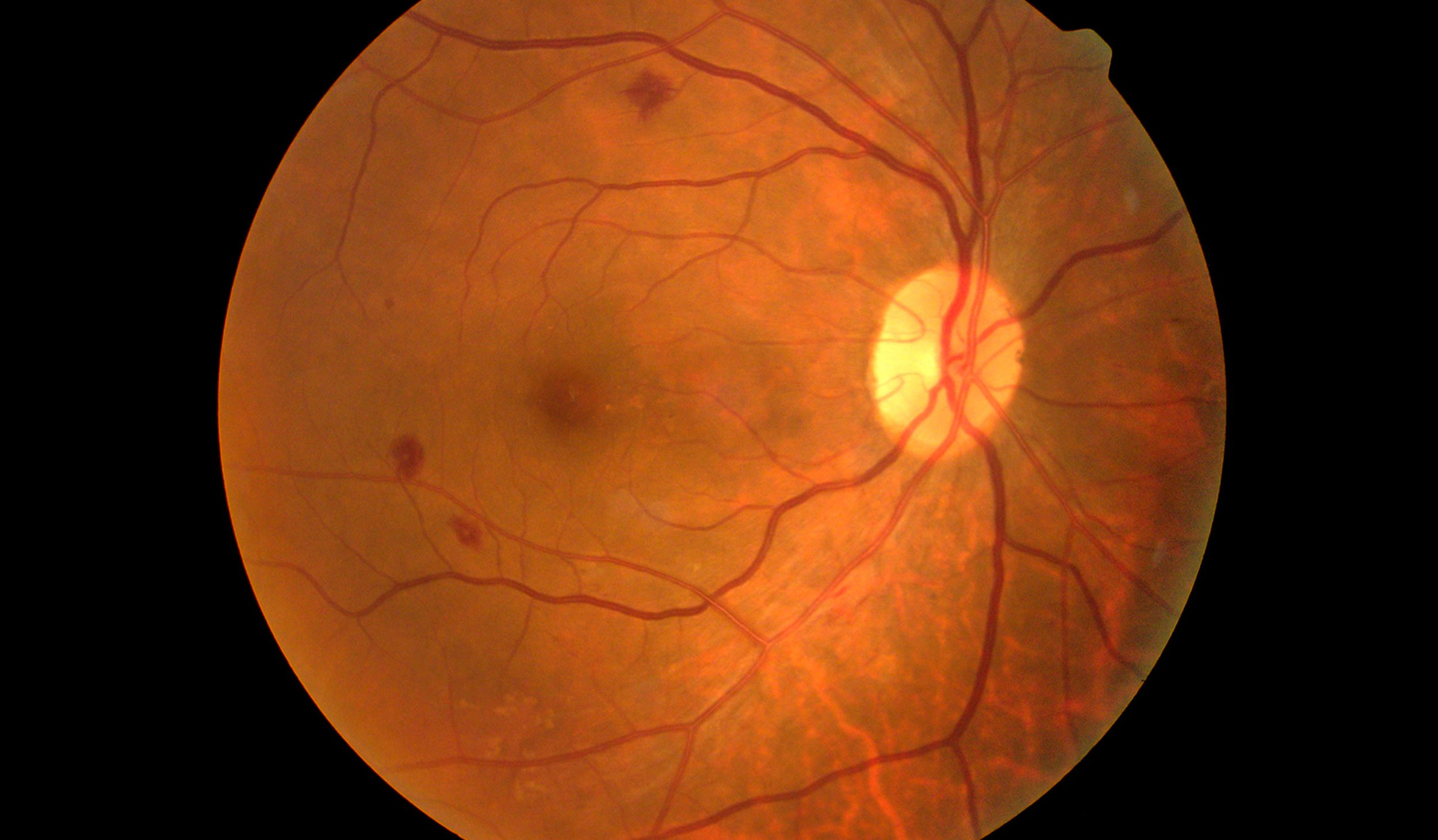 View of the back of a retina