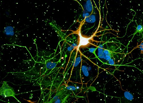 Neural Development Application