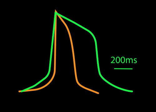 Cardiac Classification