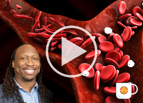 Manu platt webinar on sickle cell disease and using the Maestro Z for barrier integrity analysis
