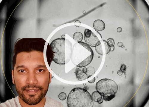 Predicting Chemotherapy Response with Patient-Derived Gastric Cancer Organoids